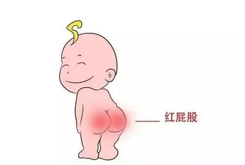 做好這三點(diǎn)，寶寶遠(yuǎn)離“紅屁股”