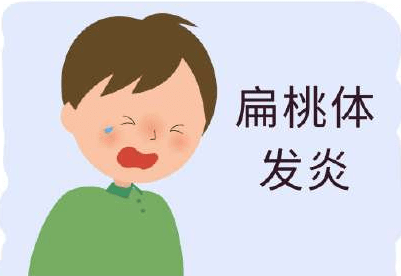 扁桃體發(fā)炎也會(huì)引起寶寶頻繁高燒